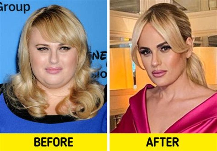 15 Celebs Who Have Struggled With Their Weight